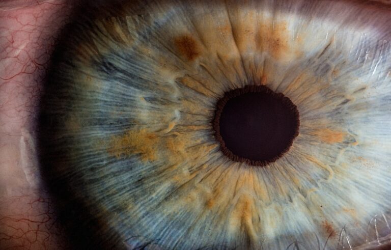 A close-up of an eye exam with a doctor using bright lights and a patient’s eye in focus.